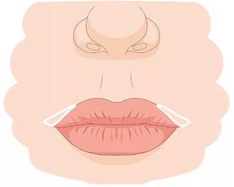 Ilustrace k zákroku